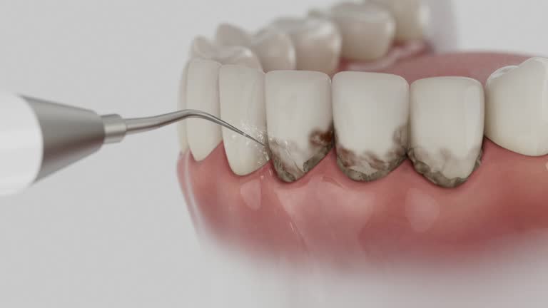 Trusted Root Canal Treatment service in Owosso, MI - Dentist Open Now